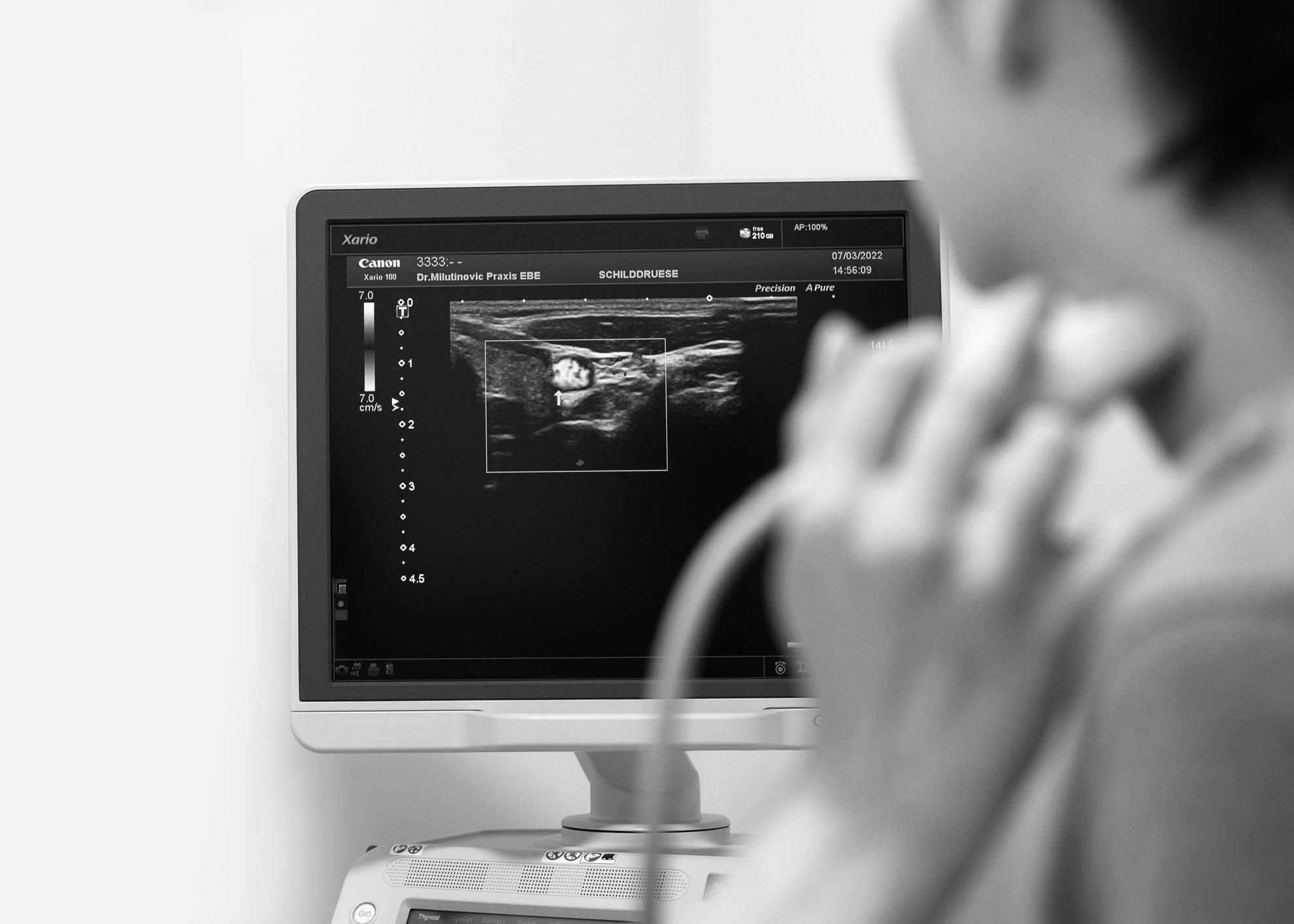 Diagnose Ultraschalluntersuchung